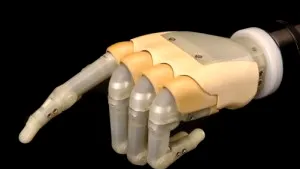 World’s First Bionic Hand Makes It To Romanian Market