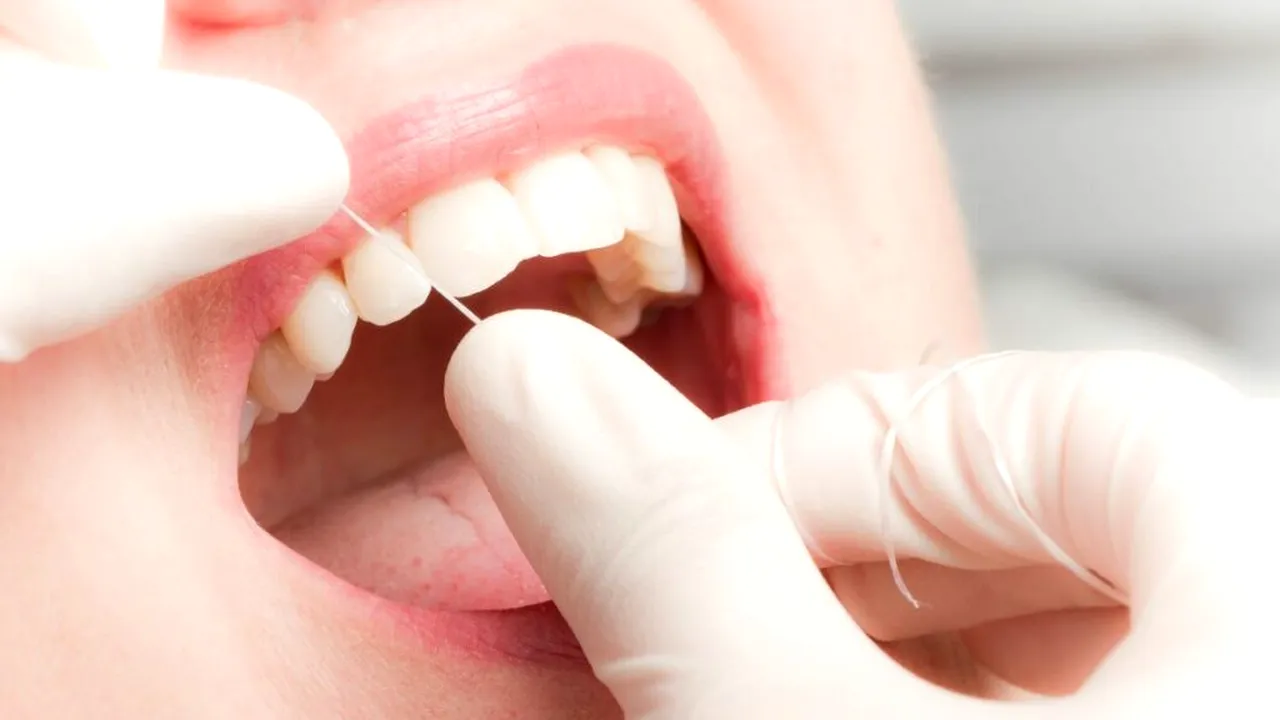 Dieta care vindecă gingiile dureroase. Poate reduce cu până la 65% inflamaţiile