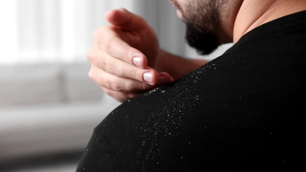 Șampon antimătreață: cum funcționează ingredientele active (P)