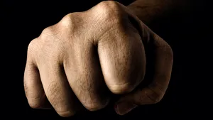 Un bărbat din Botoşani a murit după ce a fost lovit cu pumnul în faţă de un adolescent 