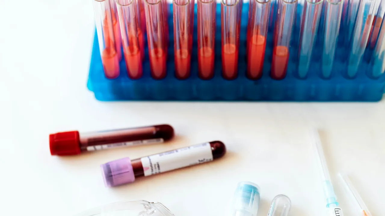 Ziua Mondială a Diabetul: ultimele inovaţii ale cercetării şi tehnologiei