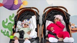 Operaţie de separare reuşită în cazul siamezelor pakistaneze Minal şi Mirha