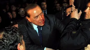 Berlusconi rămâne sub supraveghere medicală, dar nu va fi operat - VIDEO, GALERIE FOTO