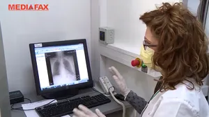 La Spitalul din Timişoara toţi pacienţii fac radiografii la plămâni înainte de a fi internaţi