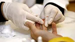 Primul „test de sânge precis” pentru detectarea sindromului de oboseală cronică