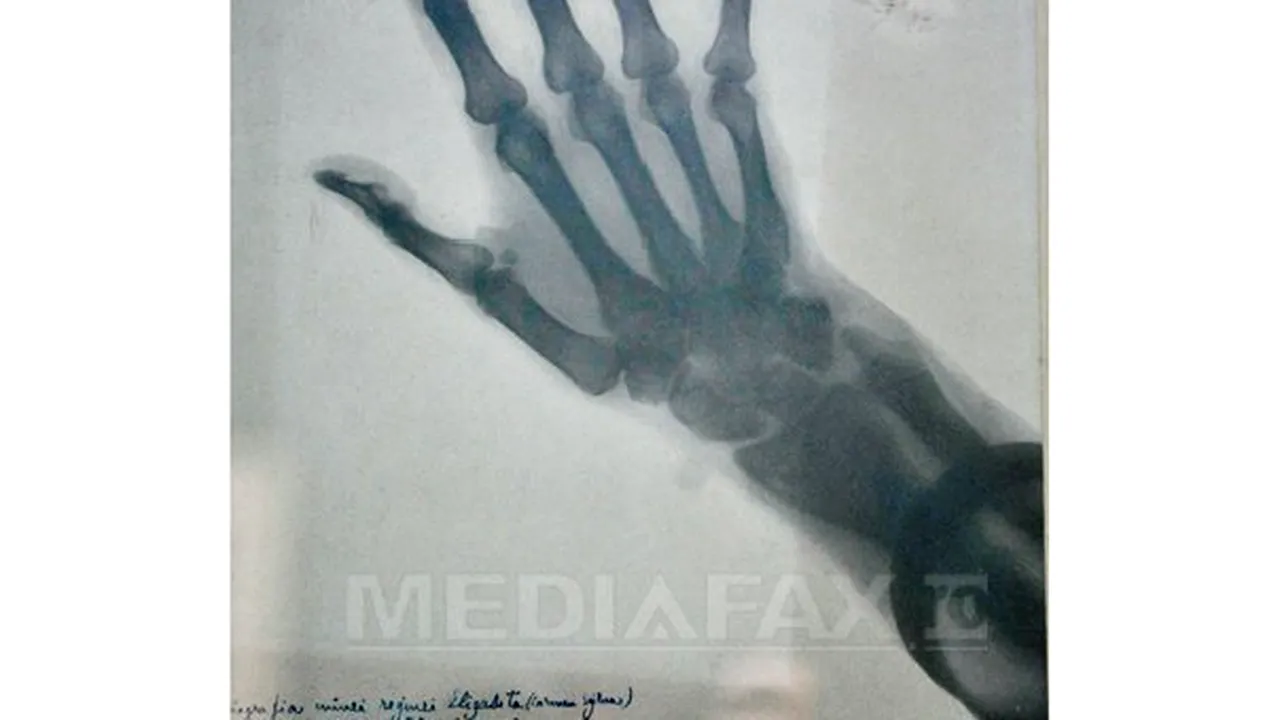 Radiografia mâinii drepte a reginei Elisabeta, vândută la licitaţia Artmark. Cu ce sumă a fost achiziţionată