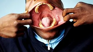 5 recorduri extreme: de la cea mai elastică falcă la cel mai mare nas