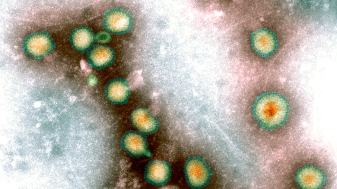 Al cincilea caz de mpox cu tulpina Clade 1b confirmat în Marea Britanie