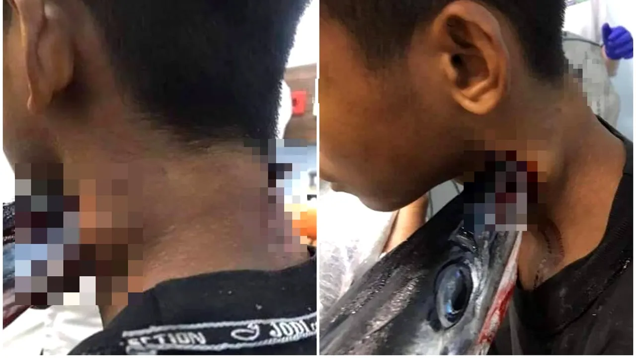 Un adolescent a supravieţuit după ce a fost înjunghiat în gât de un zărgan. Cinci medici au fost nevoiţi să îl opereze - FOTO