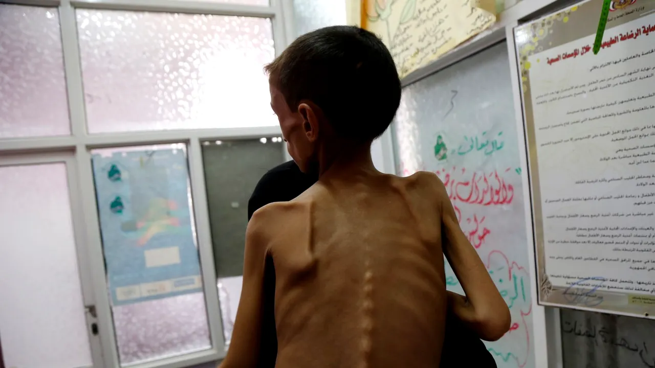 Criză umanitară în Yemen: peste 13 milioane de oameni suferă de foamete