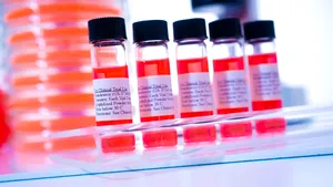 Cum va arăta viaţa noastră dacă vaccinul anti-COVID dă greş. Un alt virus fără vaccin a ucis 32 milioane oameni în 40 de ani