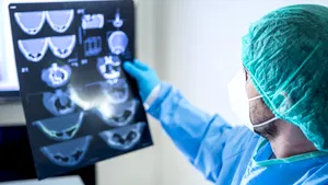 Un nou studiu ALARMANT despre COVID-19. Poate afecta GRAV creierul, iar milioane de oameni pot avea probleme pe viaţă