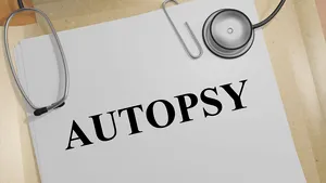 Un deţinut din Spania, declarat mort, a început să sforăie pe masa de autopsie. Familia cere acum eliberarea imediată a bărbatului