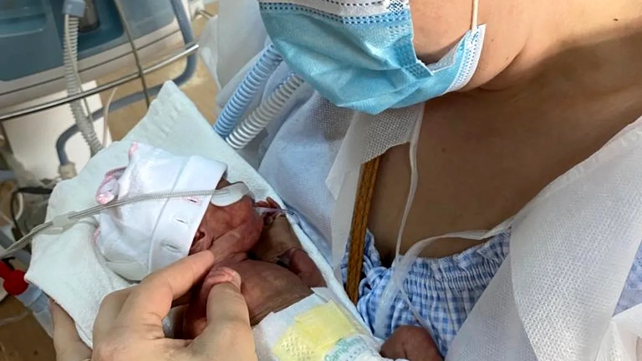 Ziua Mondială a Prematurităţii. Cel mai mic prematur născut la SUUB avea sub 500 de grame