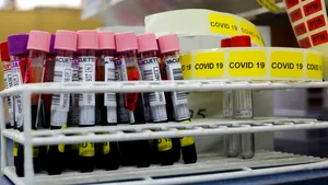 Studiile clinice se concentrează pe un tratament bazat pe anticorpi care să neutralizeze coronavirusul în persoanele sănătoase