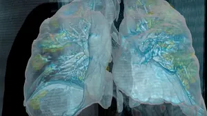 Un clip 3D arată cum atacă noul coronavirus plămânii