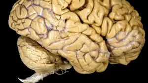 Structurile cerebrale determină orientările politice ale oamenilor