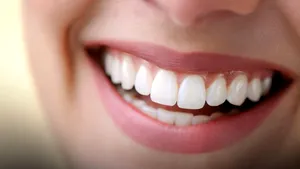 Poți avea un zâmbet perfect fără durere? Estetica dentară modernă schimbă totul (P)