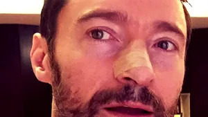 Hugh Jackman a suferit o nouă intervenţie chirurgicală pentru extirparea unor celule canceroase