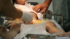 Circumcizia reduce riscurile îmbolnăvirilor pe cale sexuală