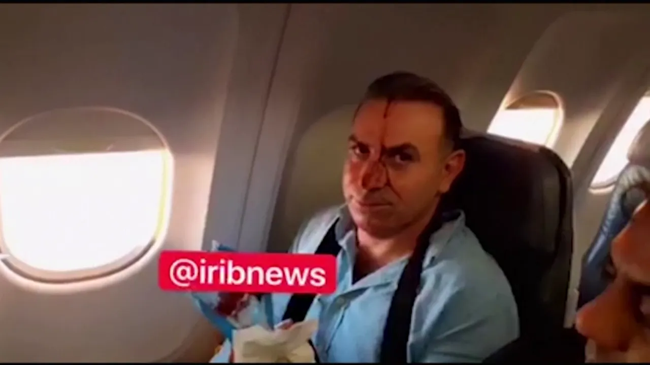 VIDEO. Un avion de vânătoare american s-a apropiat periculos de o aeronavă iraniană de pasageri. Mai multe persoane au fost rănite 