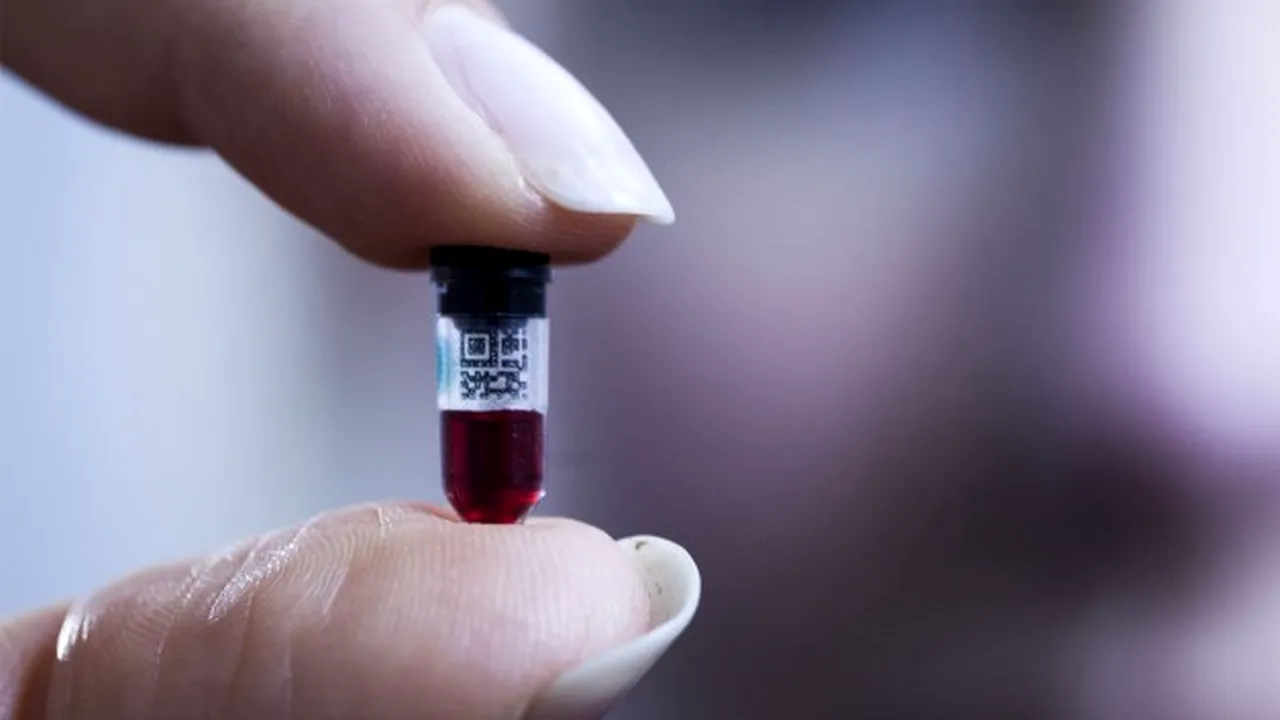 Theranos, compania care promitea să revoluţioneze analizele medicale, închide toate laboratoarele