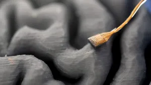 China transformă implanturile cerebrale cu inteligență artificială în produse comerciale