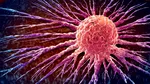 Descoperire genetică: gena colesterolului care influenţează cancerul de sân