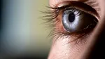 Un nou tip de soft AI ar putea identifica persoanele expuse riscului de anemie prin examinarea ochilor