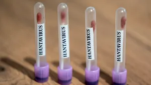 Focarul de hantavirus se extinde: Spania anchetează un caz suspect legat de nava MV Hondius
