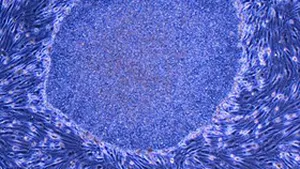 Celule suşă, extrase fără a distruge embrionul uman