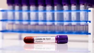 COVID-19. Ţara europeană care testează toată populaţia. Planul ambiţios anunţat de guvern