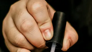Semnul de pe unghie care poate sugera cancerul: atenţionări despre melanomul unghial