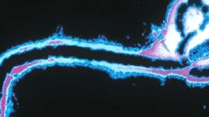 Specialiştii americani au modificat virusul Ebola în speranţa că vor descoperi un tratament