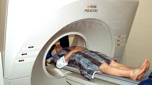 Tomograful, mai eficient pentru depistarea cancerului pulmonar decât razele X