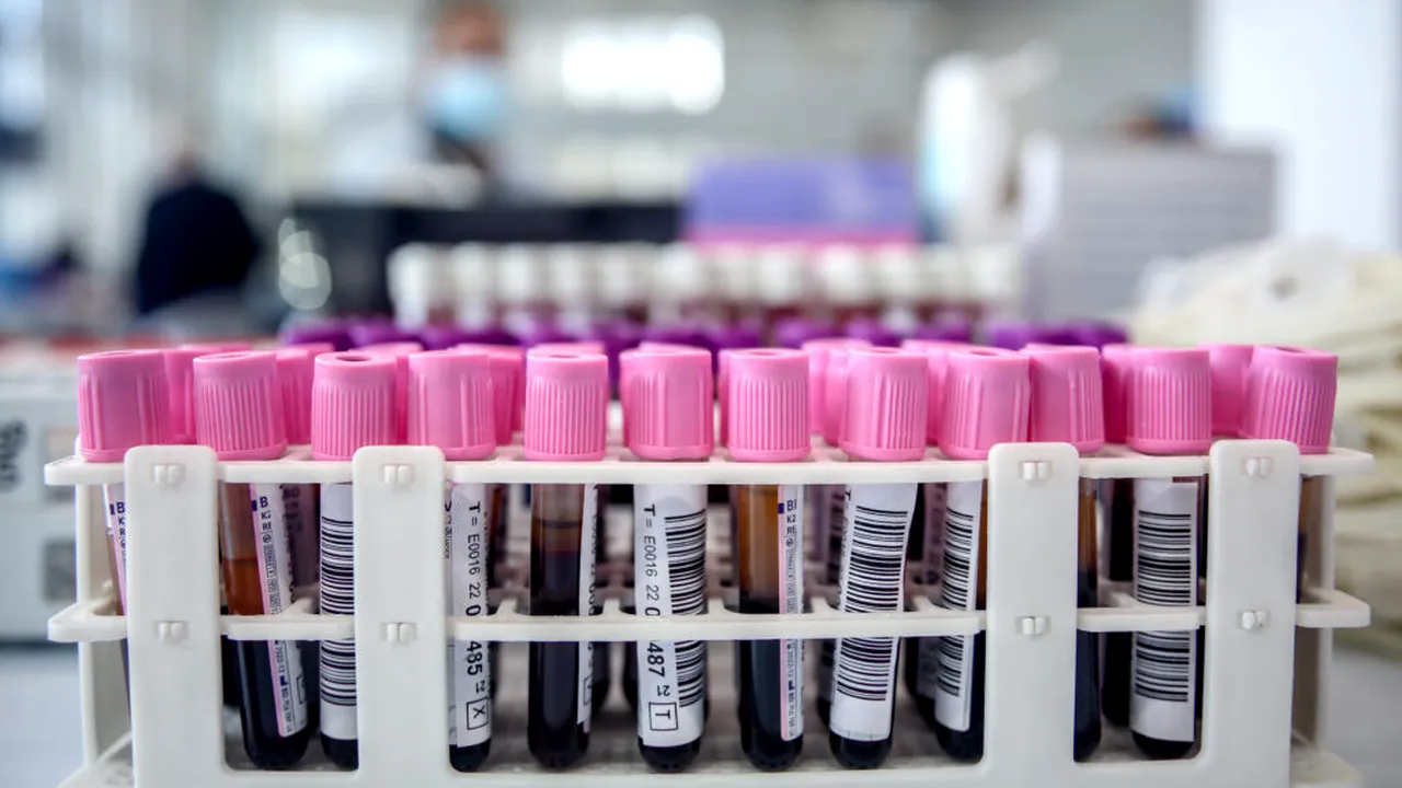 Un test de sânge ar putea detecta boala Parkinson înainte de apariția simptomelor