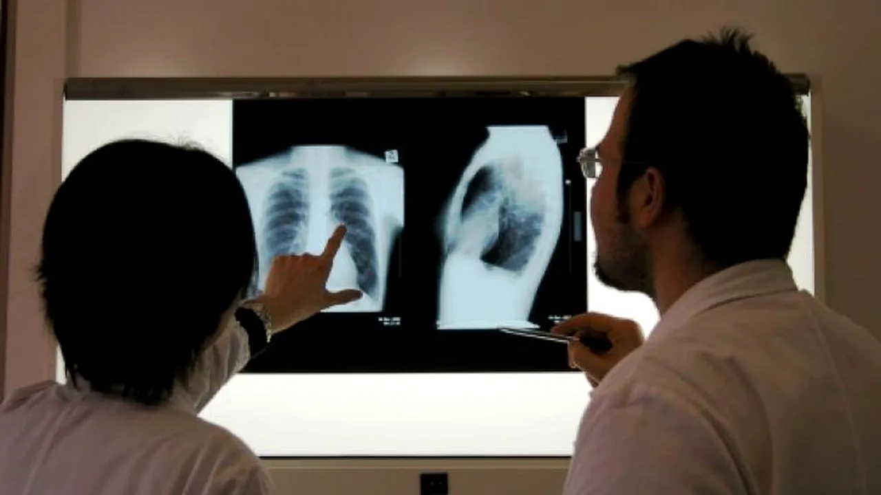 INSP: România continuă să înregistreze cea mai ridicată rată a incidenței Tuberculozei din UE / Tristele date ale Zilei Mondiale a Tuberculozei
