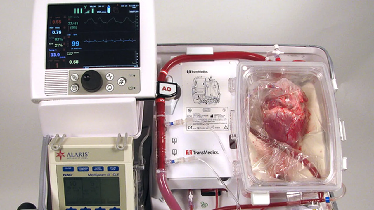PREMIERĂ în Europa: Primul transplant al unei inimi care a încetat să bată în corpul donatorului a fost realizat cu succes
