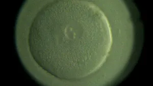 MS: Unităţile sanitare pot efectua proceduri de inseminare artificială şi fertilizare in vitro