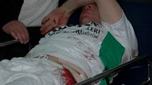 Turcia: Doi fotbalişti au fost înjunghiaţi de un suporter