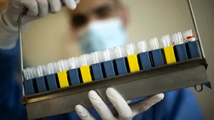 Test rapid pentru depistarea COVID-19, dezvoltat în Italia. Identifică trei tulpini SARS-CoV-2 în două ore