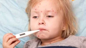 Tot mai multe cazuri de rujeolă în România