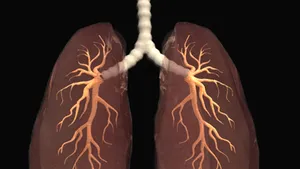 O alternativă la transplant: Plămânul portabil