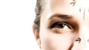 Ridurile pot prezice riscul de producere a fracturilor osoase