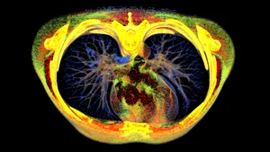 Geneticienii sunt în alertă! Coronavirusul a suferit o mutaţie care îi permite să se transmită mai repede şi care îl face mai rezistent