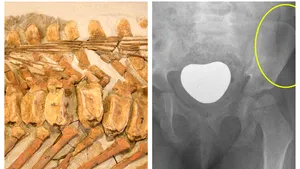 Premieră în lumea ştiinţei: o boală rară, veche de 66 de milioane de ani, care face victime azi, descoperită în fosila unui dinozaur