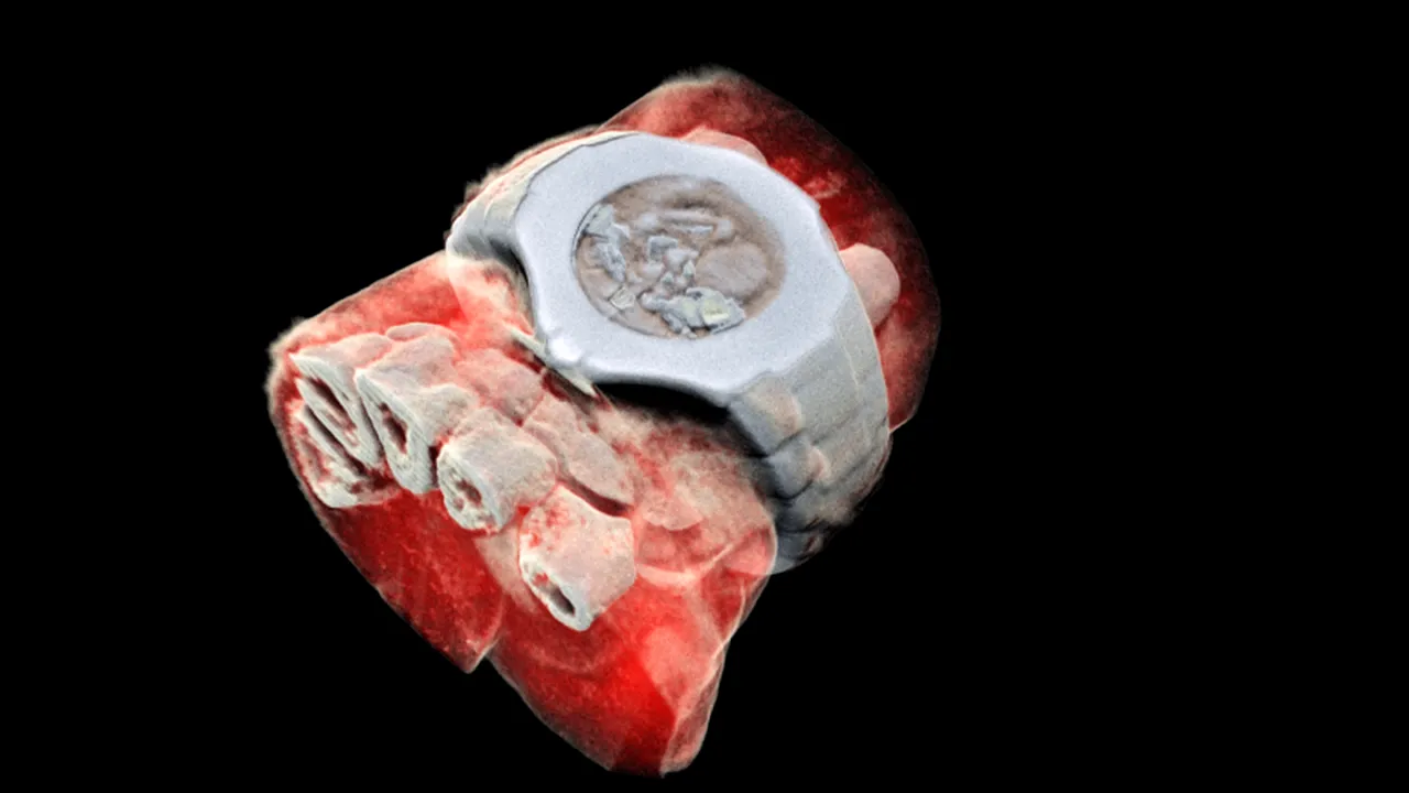 A fost inventat aparatul care face radiografii 3D, color. Acesta foloseşte tehnologie CERN