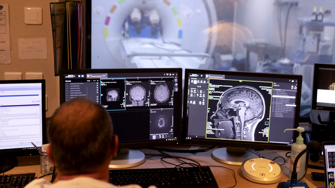 Studiu: Cazurile de Parkinson s-ar putea dubla la nivel mondial până în 2050