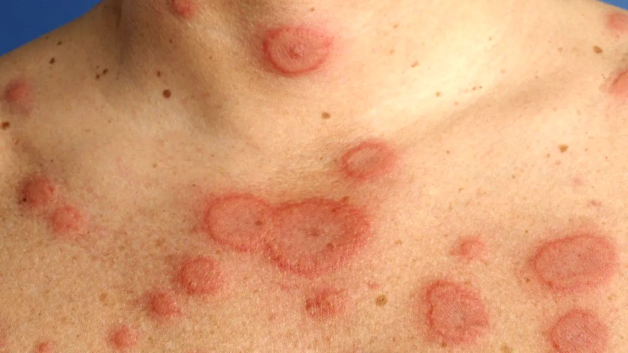 Boală extrem de contagioasă, depistată în Ucraina, la graniţa cu România. Autorităţile au început să ia măsuri / Maladia fost eradicată în ţara noastră în 1980