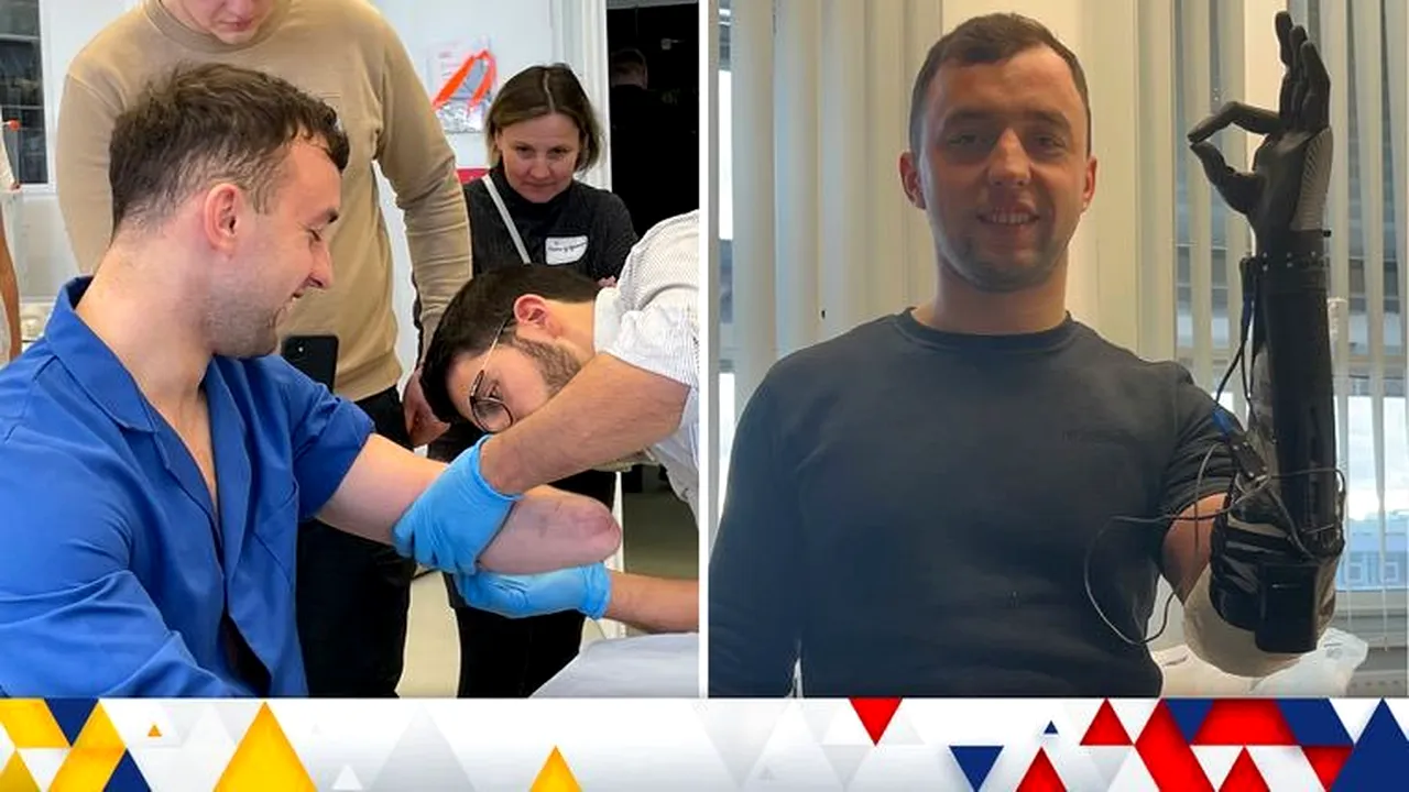 Doi soldaţi ucraineni, care au fost grav răniţi, vor primi braţe bionice de ultimă generaţie 